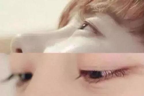 吃瓜脸上贴睫毛,脸上贴睫毛的时尚新玩法